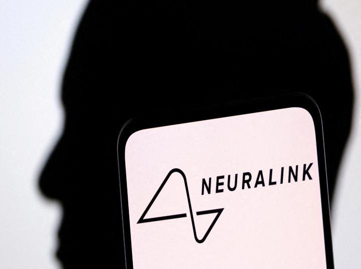 ¿La nueva evolución? Neuralink, con aprobación para estudios de implantes cerebrales en humanos