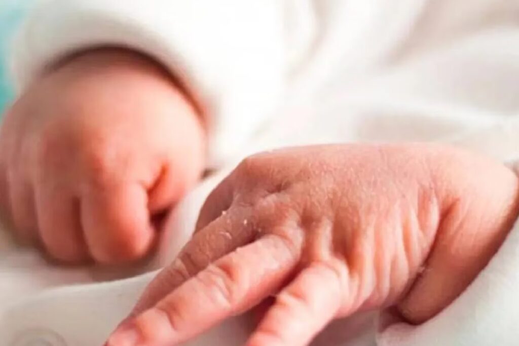 Nace bebé con 26 dedos en manos y pies