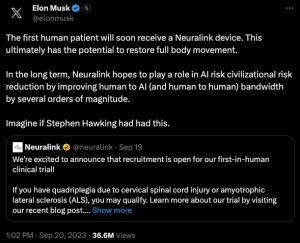 Elon Musk quiere más ancho de banda para la interfaz Cerebro-Computadora
