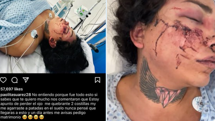Paola Suárez sufre tremenda golpiza por parte de su prometido Jesús