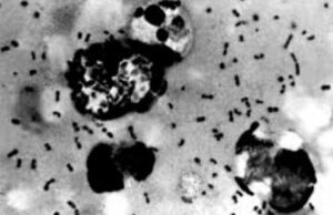 Confirman primer caso de peste bubónica en Oregón