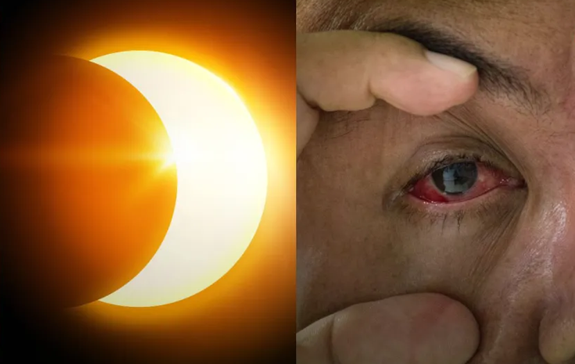 ¿Por qué me duelen los ojos? Aumentan búsquedas en Google tras el Eclipse solar