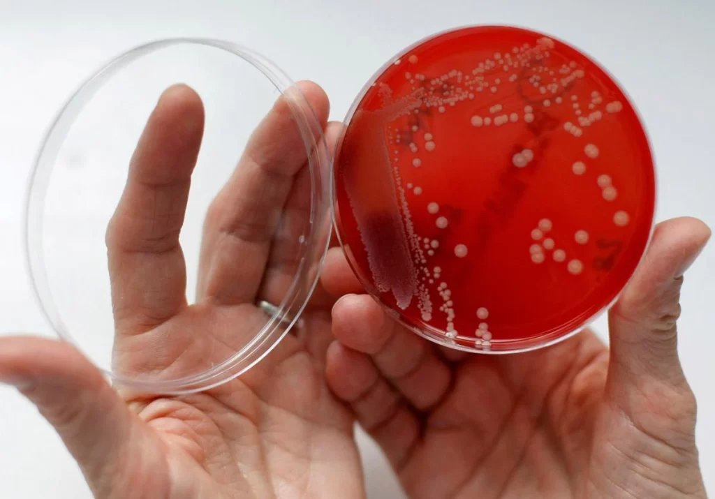 Casos graves por bacteria carnívora en Japón, se teme nueva pandemia