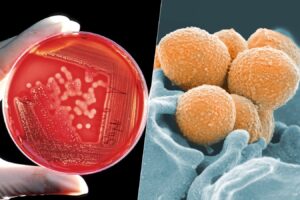 Casos graves por bacteria carnivora en Japon se teme nueva pandemia