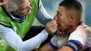 Kylian Mbappe se fractura la nariz en la Eurocopa 2024 y tendra que usar mascara