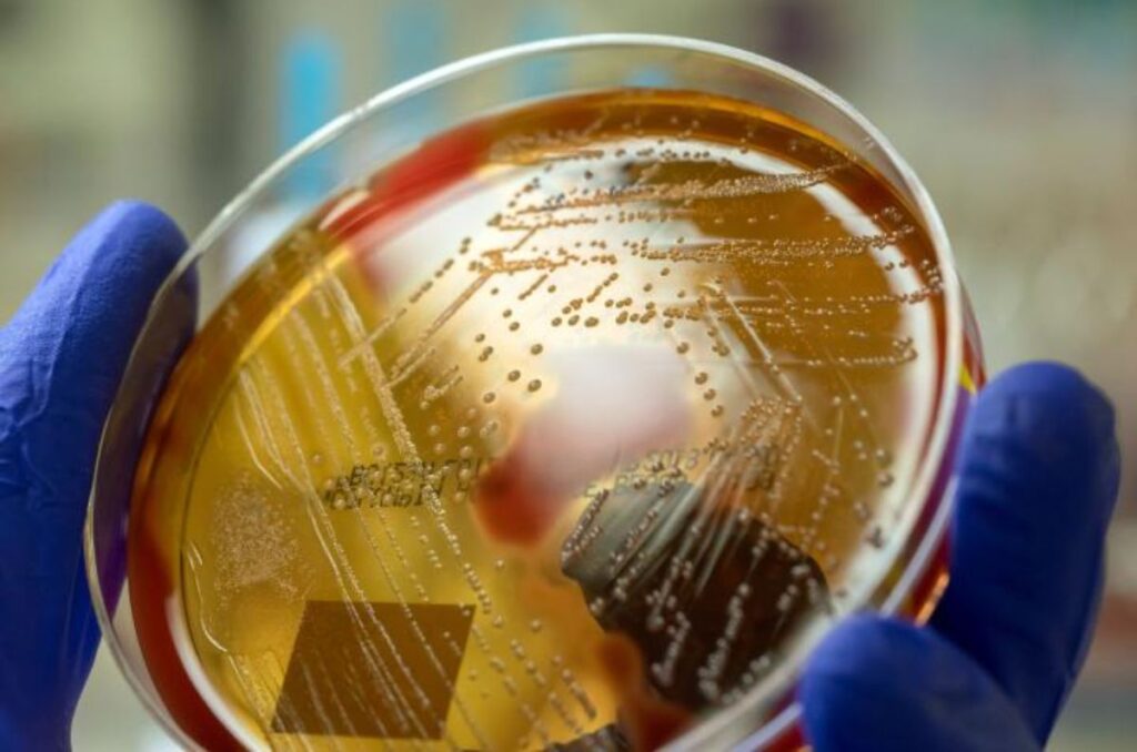 Bacteria carnívora en Japón enciende alertas en el país