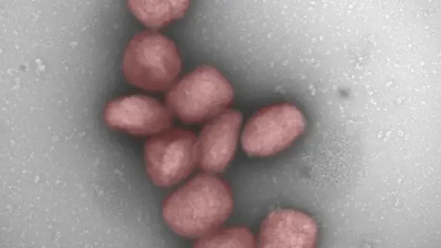 la oms en alerta ante la nueva cepa mas letal del virus mpox ya hay mas de 450 muertes y continua extendiendose por africa