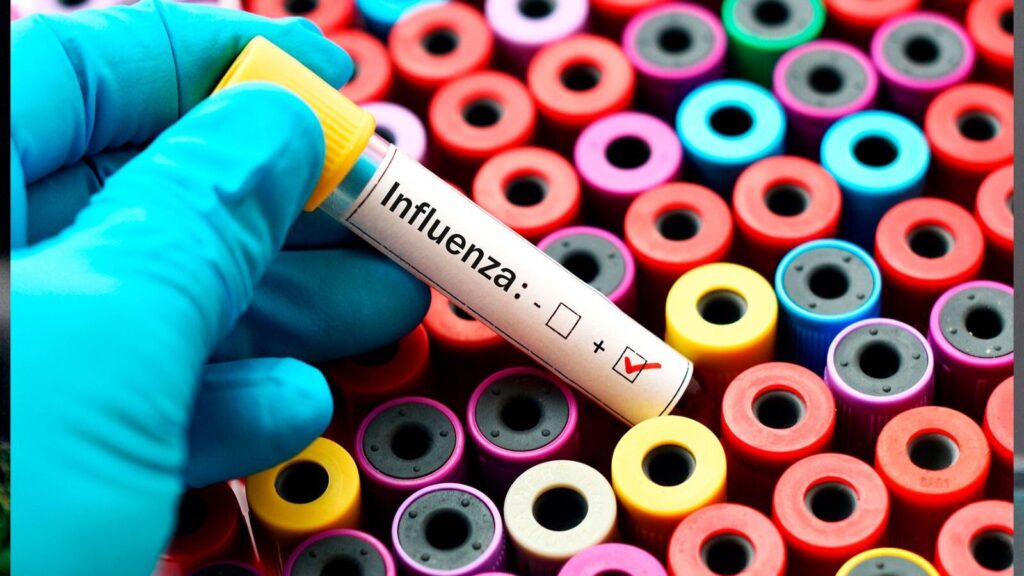 Aumentan casos de influenza en la Península de Yucatán