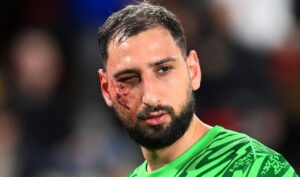 Donnarumma sufre tremendo golpe en la cara en triunfo del PSG sobre el Monaco