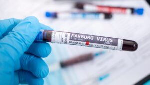 Africa en alerta por posible brote de virus mortal