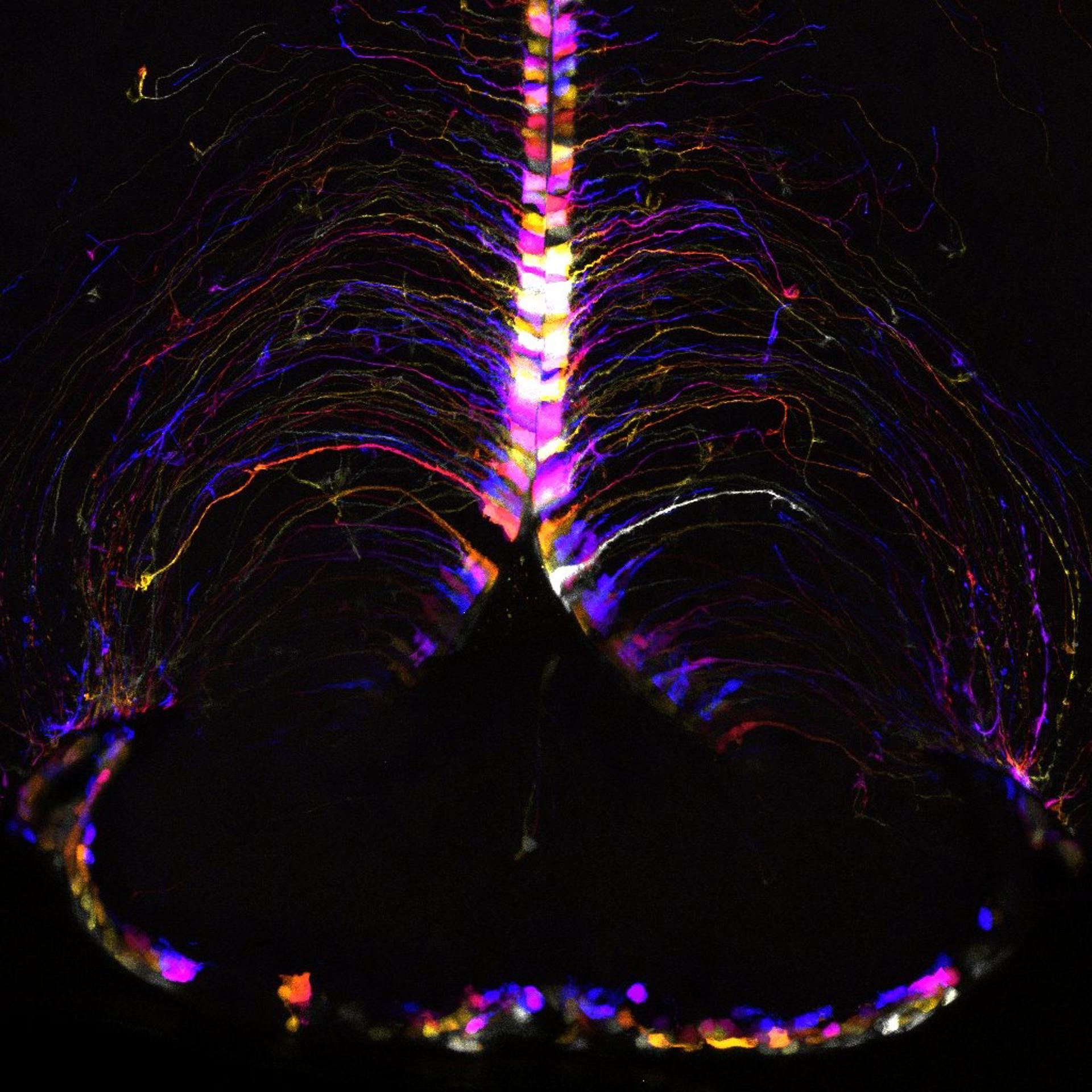 Descubren el punto caliente del cerebro donde se produce el envejecimiento