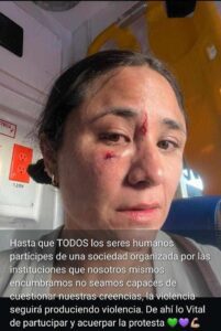 Participante en marcha del 8m resulta con fractura y lesiones en el rostro