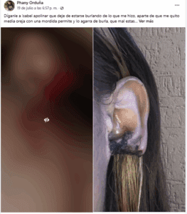 Jovencita pierde media oreja tras una pelea sentimental con amigas 