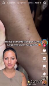 Madre exhibe a su hijo con mordidas y srasguños tras ver su novia