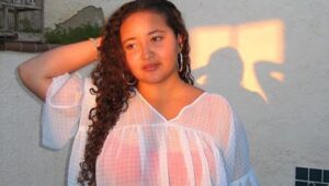 Mujer se desfiguró la cara al asar malvaviscos en una fogata
