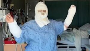 Mujer se desfiguró la cara al asar malvaviscos en una fogata