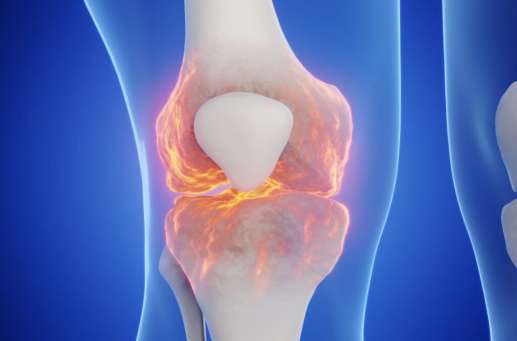 Nuevo biomaterial podría revolucionar la regeneración de cartílago dañado