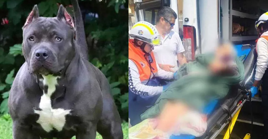 Pitbull arranca brazo a mujer de la tercera edad; arrestan a la dueña