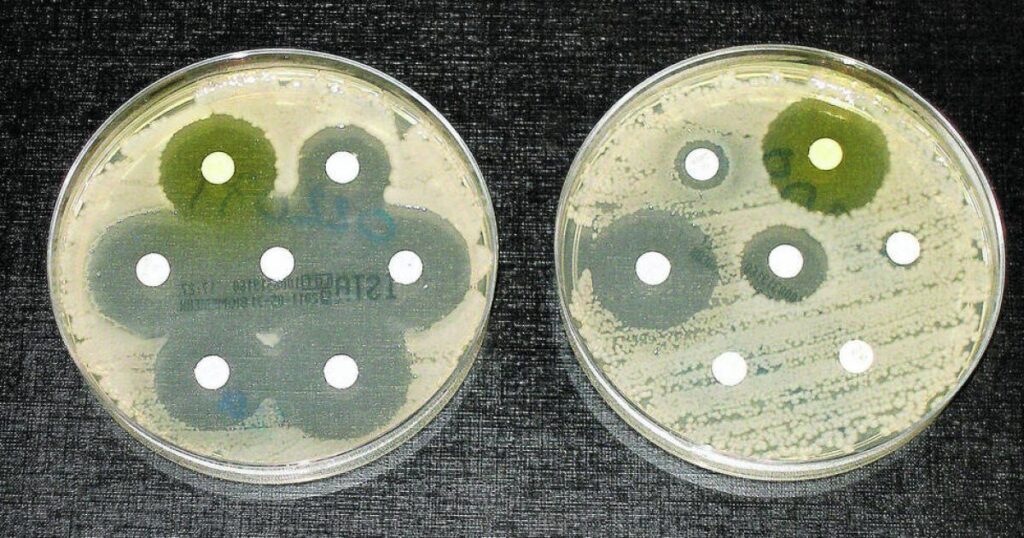 La OMS alerta sobre el rápido aumento mundial de bacterias resistentes a los antibióticos