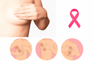 Alertan por aumento de cáncer de mama en México 