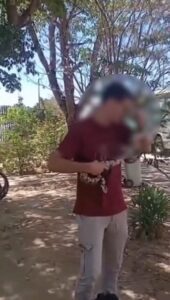 Víbora muerde a un alumno en el rostro tras quererla reubicar 